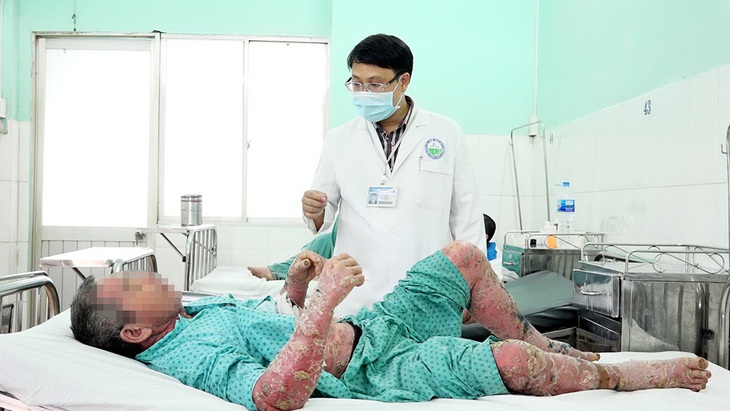 Bôi thuốc dân tộc vô, toàn thân sưng vù, nứt da, đóng vảy... - Ảnh 1. Bôi thuốc dân tộc vô, toàn thân sưng vù, nứt da, đóng vảy... - Ảnh 1.