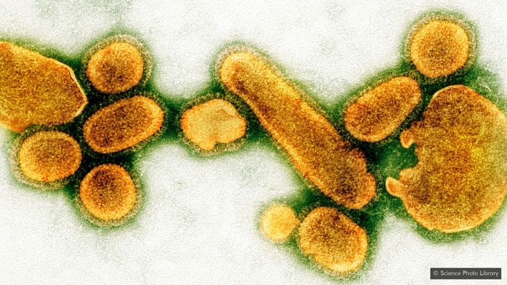 Điều gì xảy xa nếu một ngày tất cả virus biến mất? - Ảnh 1. Điều gì xảy xa nếu một ngày tất cả virus biến mất? - Ảnh 1.