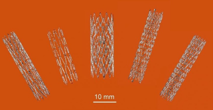 Australia tạo đột phá trong sản xuất stent nhờ công nghệ in 3D - Ảnh 1.