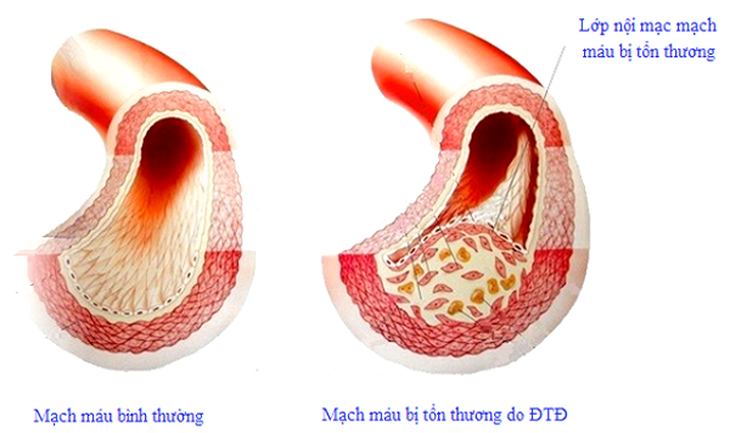 Biện pháp bảo vệ người tiểu đường trước đại dịch - Ảnh 1.