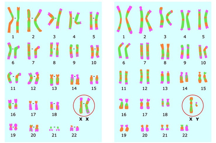 Bí mật của COVID-19: Đã có bão cytokine lại còn thêm bão bradykinin - Ảnh 3.