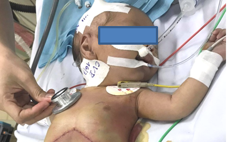 Cắt khối u gan khổng lồ nặng 2,5kg cho người đàn ông 36 tuổi - Ảnh 2.