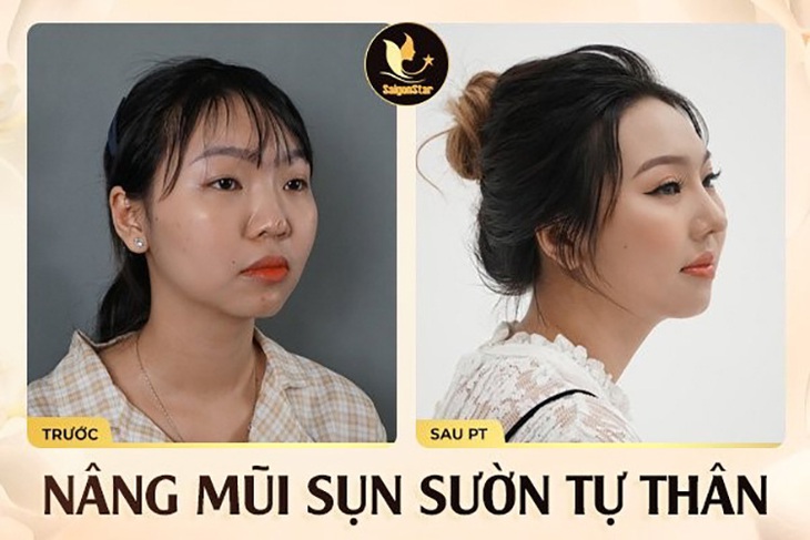 Bác sĩ Nguyễn Hữu Hoạt - chuyên gia phục hồi mũi hỏng nổi tiếng tại TP.HCM - Ảnh 4. Bác sĩ Nguyễn Hữu Hoạt - chuyên gia phục hồi mũi hỏng nổi tiếng tại TP.HCM - Ảnh 4.