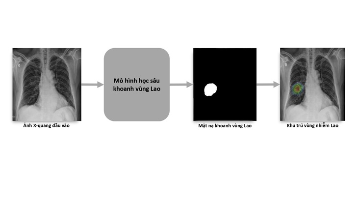 Phát hành sách trắng về ứng dụng trí tuệ nhân tạo cho chẩn đoán và tầm soát bệnh lao - Ảnh 2.