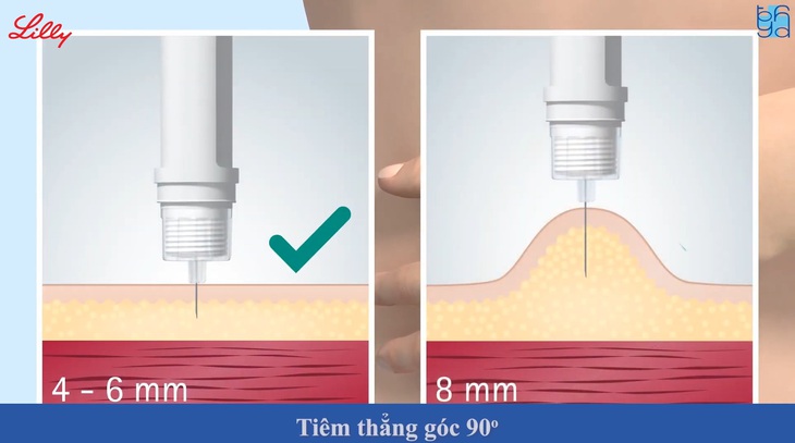 Hướng dẫn người bệnh đái tháo đường sử dụng bút tiêm Insulin - Ảnh 5.