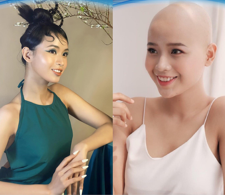 H Cúc ÊBan đăng quang Hoa hậu sinh thái Việt Nam, Cô gái bệnh ung thư thi Miss World Vietnam - Ảnh 3.