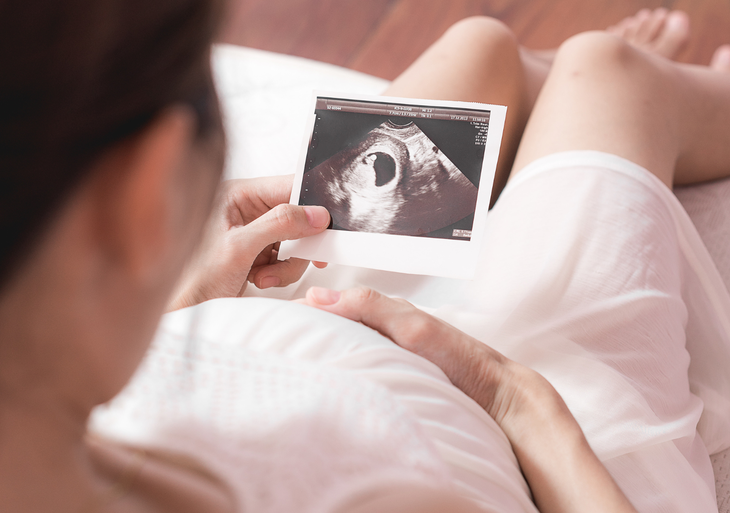 10 năm mất cân bằng giới tính khi sinh giảm chậm: Mục tiêu năm 2035 sẽ về mức tự nhiên - Ảnh 1.