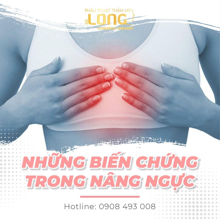 Bác sĩ Long chia sẻ kinh nghiệm nâng ngực - Ảnh 2.