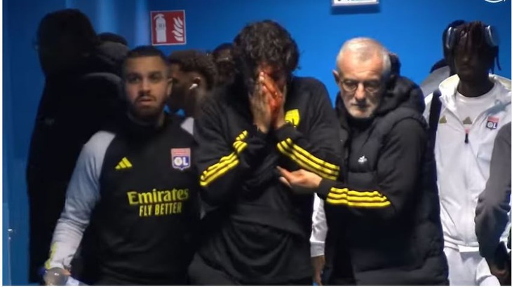 Huấn luyện viên Fabio Grosso bị thương trong vụ cổ động viên ném đá xe buýt chở đội Lyon - Ảnh: Prime