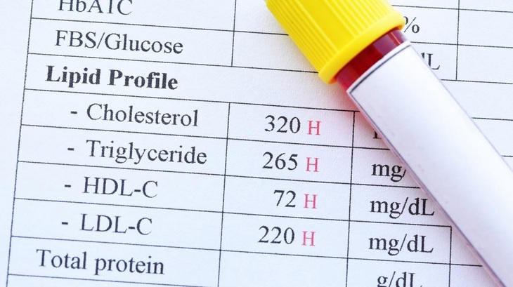 Cholesterol “tốt” không có lợi như người ta tưởng - Ảnh 1.