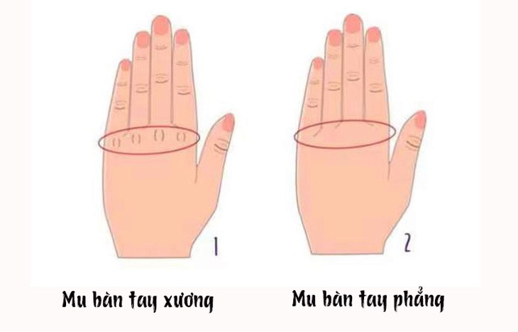 Bí mật ẩn giấu trên mu bàn tay của bạn - Ảnh 1.