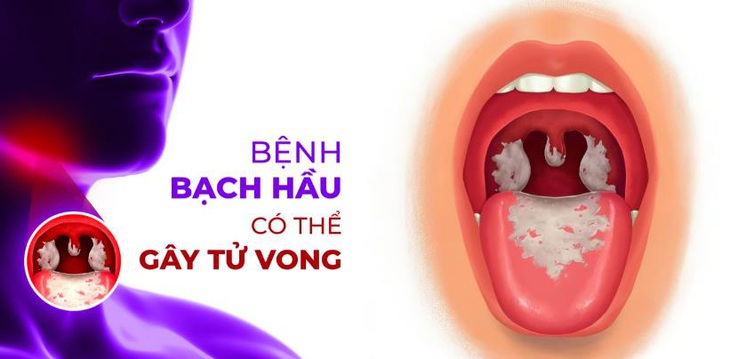 Làm gì để bảo vệ cả gia đình phòng ngừa bệnh Bạch hầu? - Ảnh 2.