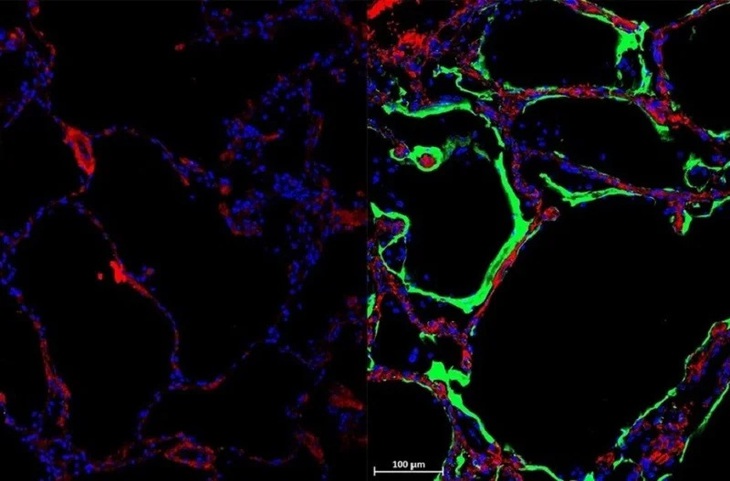 Phát hiện ra loại protein mới có thể ngăn chặn virus SARS-CoV-2 - Ảnh 1.