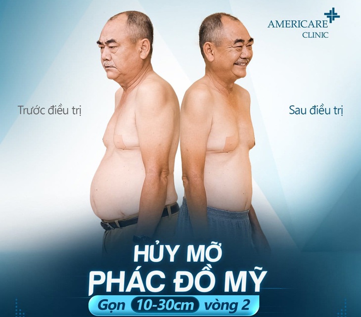 Sự thật về công nghệ siêu giảm béo - Kỳ 1: Đánh bay... 19kg mỡ - Ảnh 1.