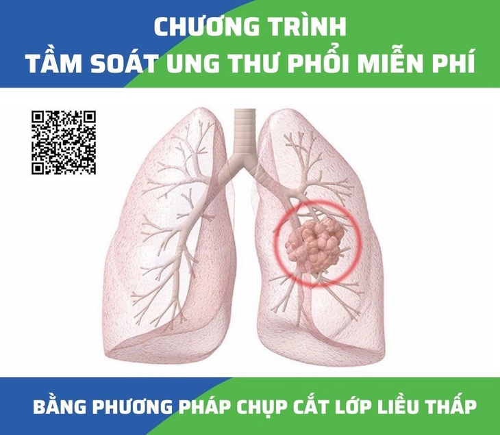 Bệnh viện Ung bướu TP.HCM tầm soát ung thư phổi miễn phí cho 600 người - Ảnh 2.