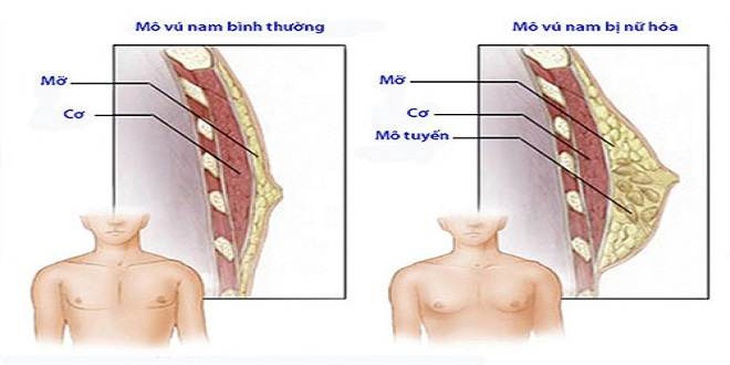 Nam giới sở hữu vòng 1 'khủng', có sao không? - Ảnh 3.