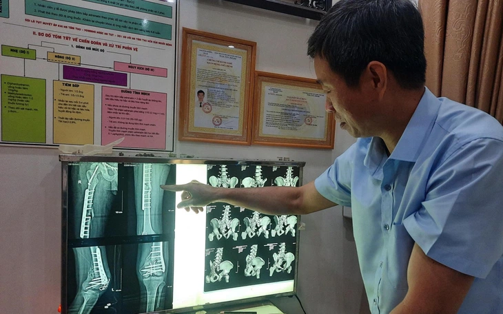 Chuyện kỳ lạ giữa lằn ranh sống - chết - Kỳ 3: Hồi phục thần kỳ sau tai nạn giao thông thảm khốc - Ảnh 4.