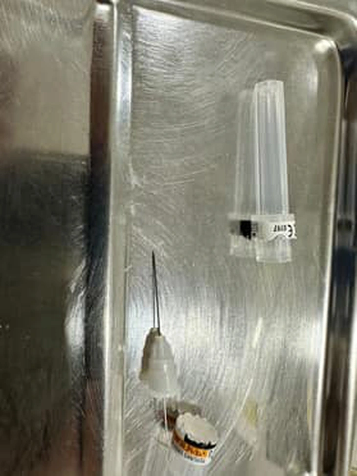 Kim chọc tủy dài 22 mm rơi vào đường thở bé trai 3 tuổi khi làm răng - Ảnh 2.