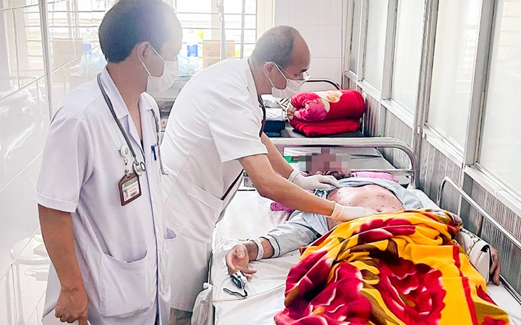 Lây thủy đậu từ con gái, người đàn ông 36 tuổi nhập viện nguy kịch - Ảnh 2.