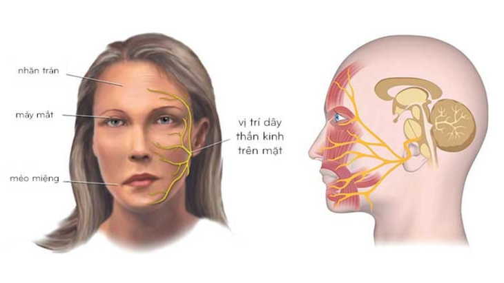 Thời tiết chuyển lạnh, coi chừng liệt dây thần kinh số 7 - Ảnh 1.