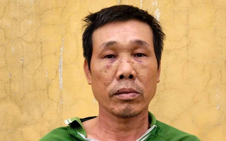 Lấy dao đâm 'bạn nhậu' vì trêu ghẹo chủ quán - Ảnh 3.