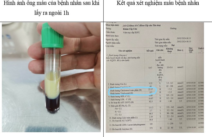 Kết quả xét nghiệm máu của bệnh nhân viêm tụy cấp tại Bệnh viện 108 - Ảnh: BVCC