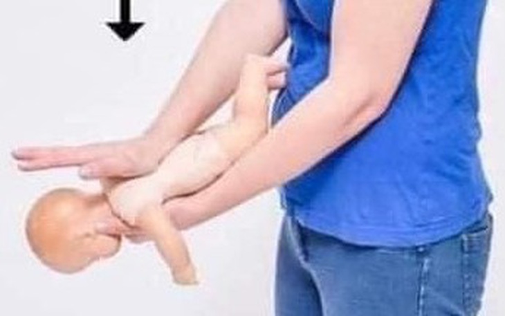 Từ vụ bé 3 tuổi tử vong vì sặc thức ăn ở nhà trẻ, bác sĩ nêu cách xử trí đúng ngay tại chỗ - Ảnh 2.