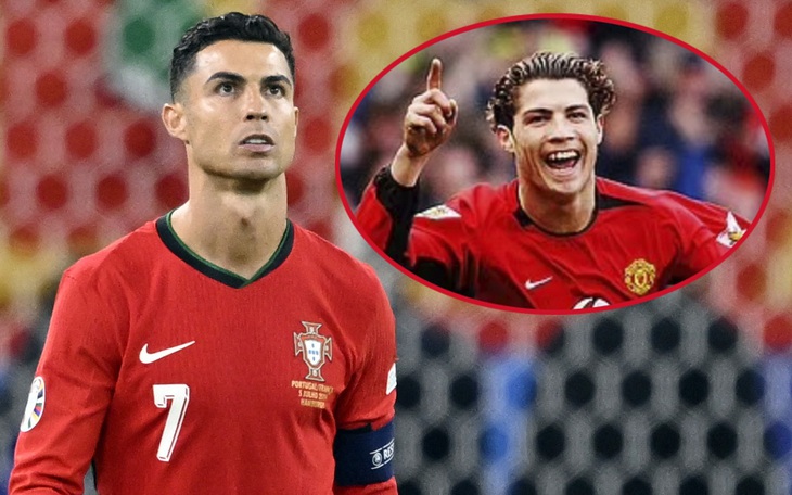 Cristiano Ronaldo dính nghi vấn phẫu thuật thẩm mỹ