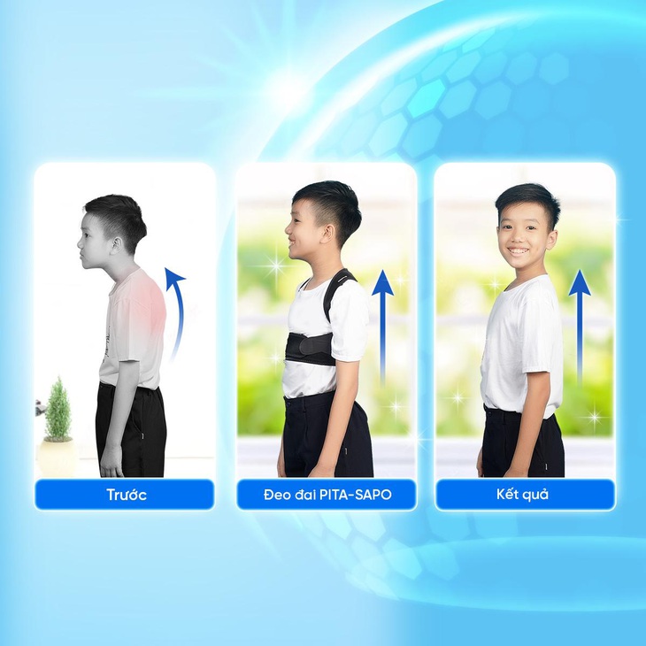Cách chọn đai chống gù lưng cho trẻ- Ảnh 1. Cách chọn đai chống gù lưng cho trẻ- Ảnh 1.