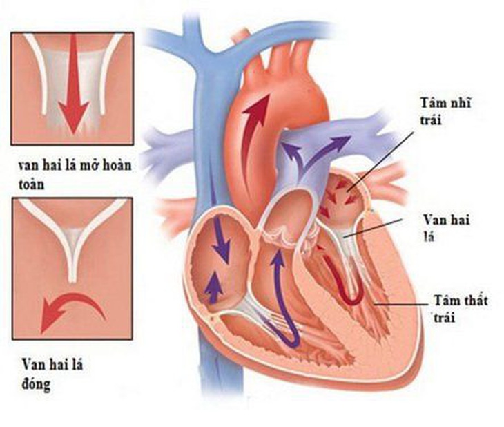 Đang làm rõ ca tử vong sau thay van động mạch chủ qua da liên quan bác sĩ Bệnh viện Bạch Mai - Ảnh 1.