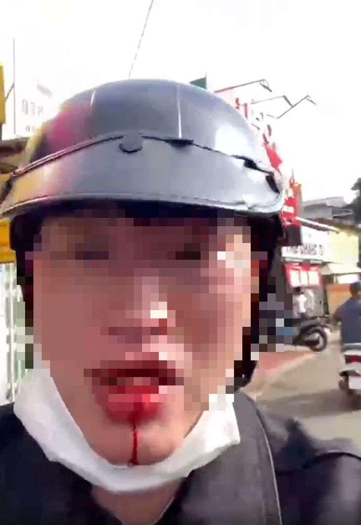 Người đàn ông lao vào đánh người rồi hỏi: 'Mày biết tao là ai không?'- Ảnh 2. mày biết tao là ai không - Ảnh 3.
