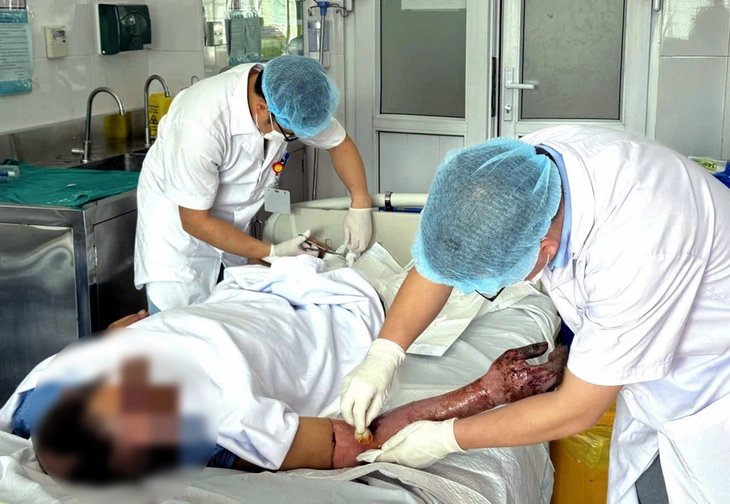 Sửa chuồng gà, người đàn ông bị bỏng nặng do tia hồ quang - Ảnh 1.