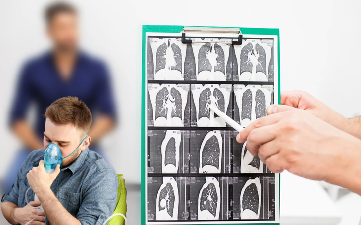 Nam bệnh nhân nhét hũ kem vào hậu môn, phải nhập viện cấp cứu - Ảnh 2.