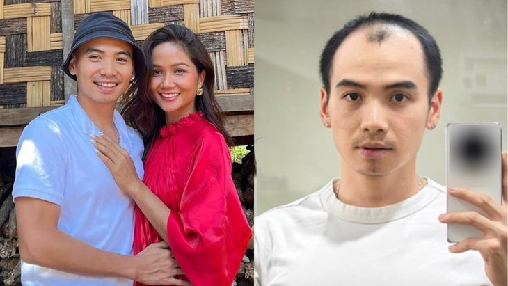 Diện mạo chồng H'Hen Niê sau 5 tháng trị hói đầu - Ảnh 1.