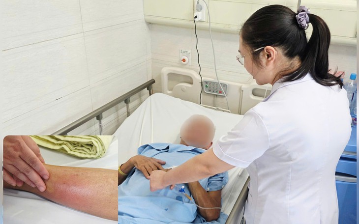 Cẩn trọng liệt từ chi từ triệu chứng dễ nhầm lẫn với thoát vị đĩa đệm - Ảnh 2.