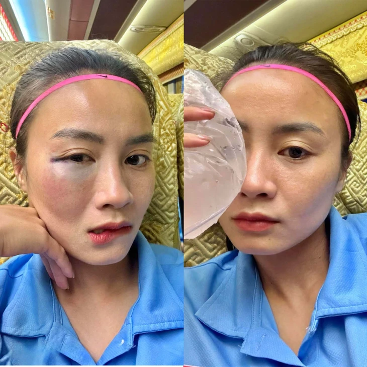 Việt Nam - Ảnh 3.