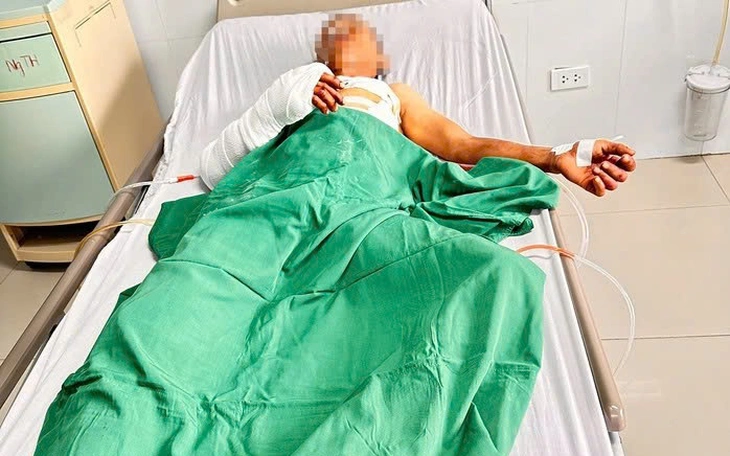 Thù hận sau ly hôn, người đàn ông dùng rựa chém hàng xóm tại tiệc tân gia - Ảnh 3.