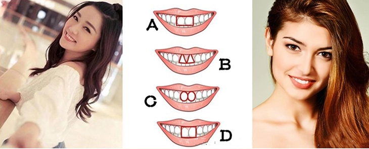 quiz - Ảnh 1.
