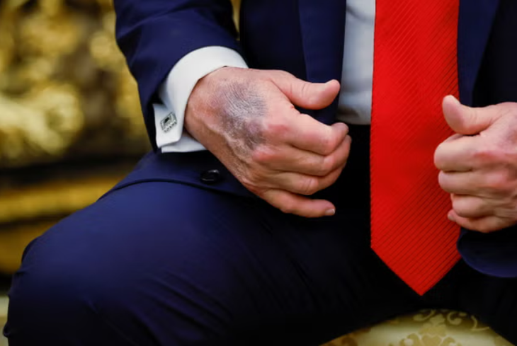 Tổng thống Trump chụp MRI ở tuổi 79, kết quả 'hoàn hảo' - Ảnh 2.
