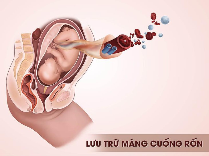 Trải nghiệm nâng ngực tại Bệnh Viện Thẩm Mỹ EMCAS - Ảnh 3.