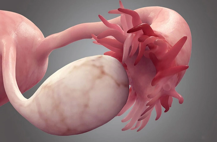 buồng trứng - Ảnh 1.