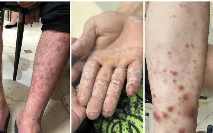 Đi dưới mưa có thể tốt cho sức khỏe hơn bạn nghĩ - Ảnh 3.