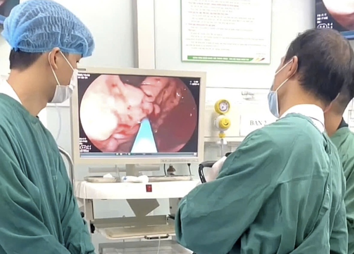 xuất huyết tiêu hóa - Ảnh 1.