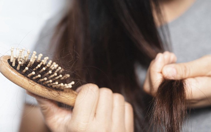 Tổng thống Hàn Quốc cứng rắn đề xuất: ‘Bảo hiểm y tế nên chi trả điều trị rụng tóc, hói đầu’ - Ảnh 3.