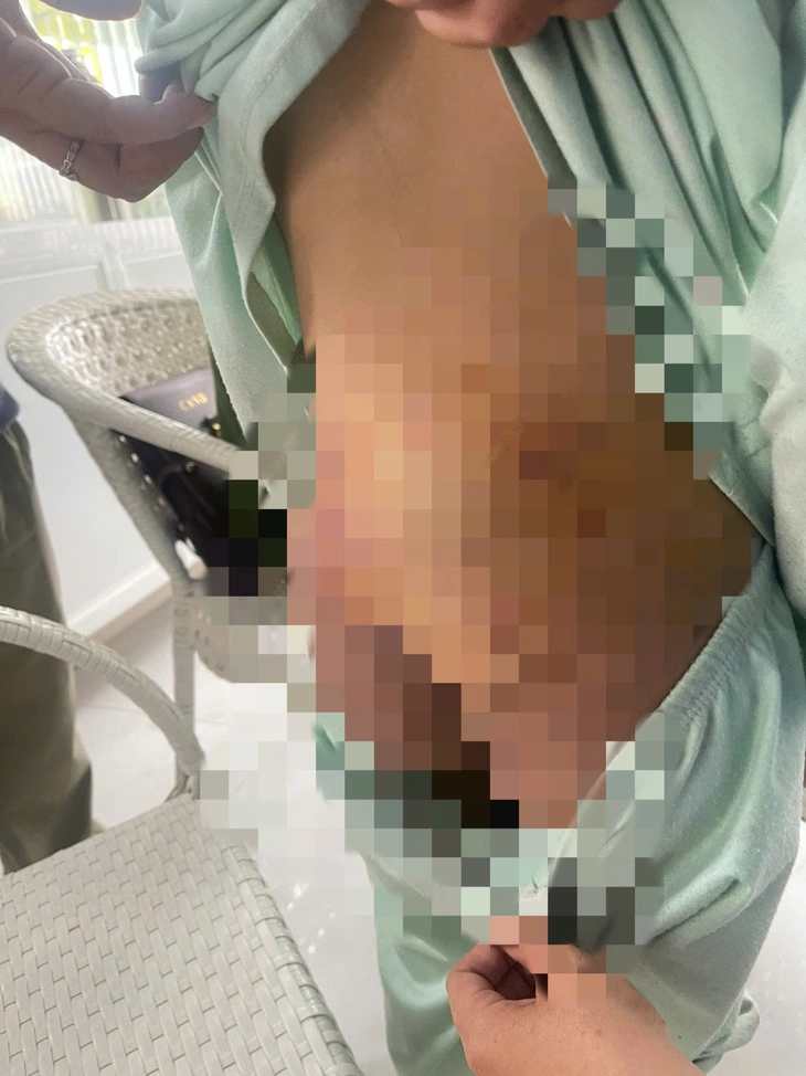 Khởi tố người phụ nữ và bạn trai bạo hành bé gái 9 tuổi ở TP.HCM - Ảnh 1. Khởi tố người phụ nữ và bạn trai bạo hành bé gái 9 tuổi ở TP.HCM - Ảnh 1.