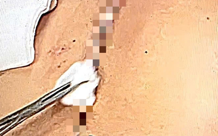 lằn ranh sống - chết - Ảnh 1.