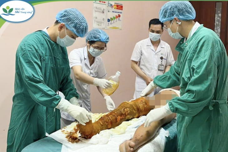 bỏng cồn - Ảnh 3.