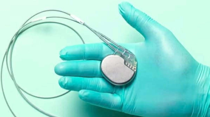 nhịp tim - Ảnh 1.