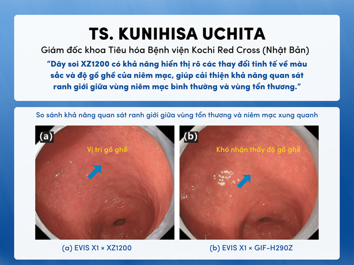 dạ dày - Ảnh 3.