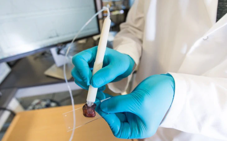 Công nghệ hình ảnh siêu nhạy giúp phát hiện ung thư sớm - Ảnh 2.